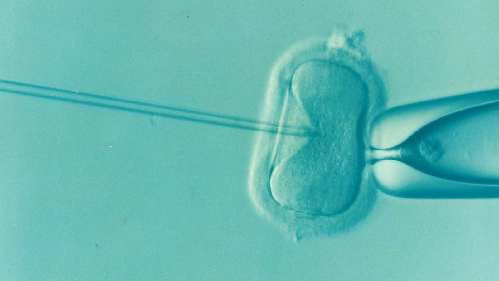Infertility and Advanced Fertility Treatments 1 ivf g0e639a341 1920 -